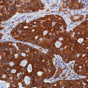 Immunohistochemistry (Formalin/PFA-fixed paraffin-embedded sections) - Anti-STING antibody [SP339] - BSA and Azide free (AB238796)