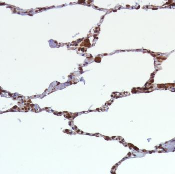 Immunohistochemistry (Formalin/PFA-fixed paraffin-embedded sections) - Anti-STING antibody [SP339] - BSA and Azide free (ab238796), expandable thumbnail
