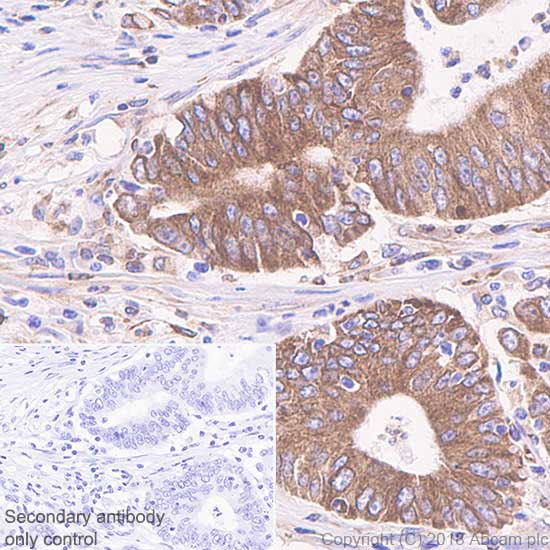 Immunohistochemistry (Formalin/PFA-fixed paraffin-embedded sections) - Anti-STING antibody [SP339] - BSA and Azide free (AB238796), expandable thumbnail