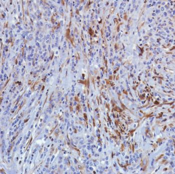 Immunohistochemistry (Formalin/PFA-fixed paraffin-embedded sections) - Anti-STING antibody [SP339] - BSA and Azide free (ab238796), expandable thumbnail