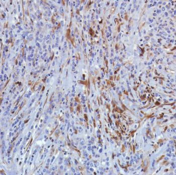 Immunohistochemistry (Formalin/PFA-fixed paraffin-embedded sections) - Anti-STING antibody [SP339] - BSA and Azide free (AB238796)