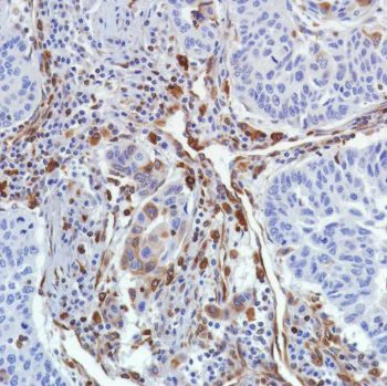 Immunohistochemistry (Formalin/PFA-fixed paraffin-embedded sections) - Anti-STING antibody [SP339] - BSA and Azide free (AB238796)