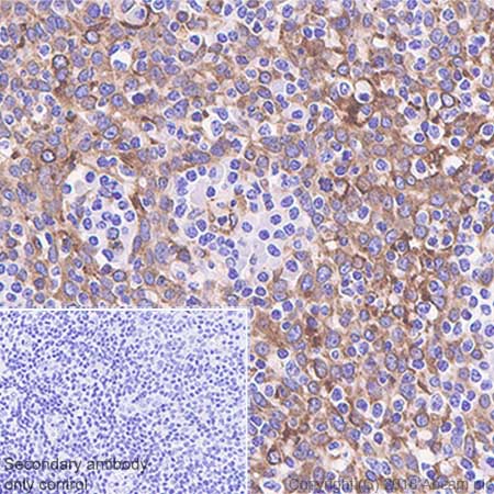 Immunohistochemistry (Formalin/PFA-fixed paraffin-embedded sections) - Anti-STING antibody [SP339] - BSA and Azide free (AB238796), expandable thumbnail
