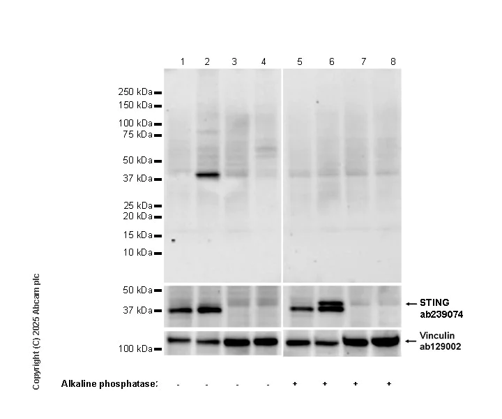 Western blot - Anti-STING (phospho S366) antibody [EPR29040-93] - BSA and Azide free (AB324230)