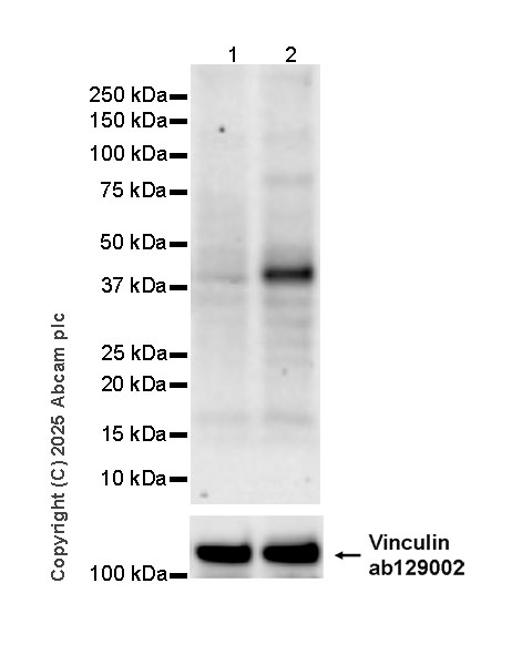 Western blot - Anti-STING (phospho S366) antibody [EPR29040-93]  - BSA and Azide free (AB324230), expandable thumbnail