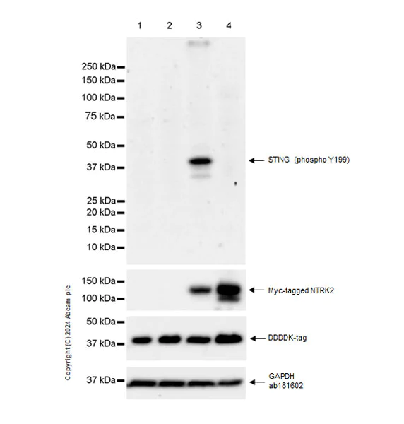 Western blot - Anti-STING (phospho Y199) antibody [EPR22728-11] - BSA and Azide free (AB318182)