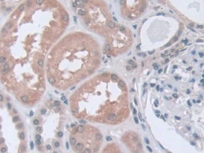 Immunohistochemistry (Formalin/PFA-fixed paraffin-embedded sections) - Anti-STIP1/STI1 antibody (AB233196)