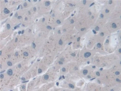 Immunohistochemistry (Formalin/PFA-fixed paraffin-embedded sections) - Anti-STIP1/STI1 antibody (AB233196)