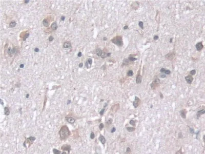 Immunohistochemistry (Formalin/PFA-fixed paraffin-embedded sections) - Anti-STIP1/STI1 antibody (AB233196)