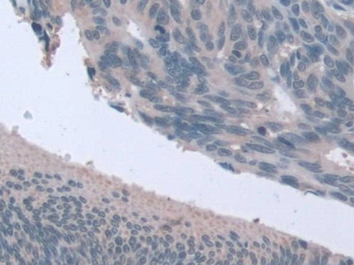 Immunohistochemistry (Formalin/PFA-fixed paraffin-embedded sections) - Anti-STIP1/STI1 antibody (AB233196)