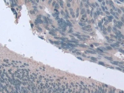 Immunohistochemistry (Formalin/PFA-fixed paraffin-embedded sections) - Anti-STIP1/STI1 antibody (AB233196)