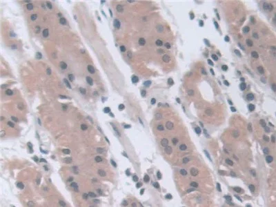 Immunohistochemistry (Formalin/PFA-fixed paraffin-embedded sections) - Anti-STIP1/STI1 antibody (AB233196)