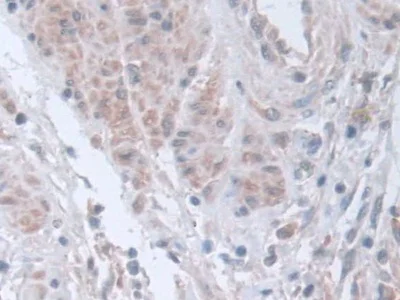 Immunohistochemistry (Formalin/PFA-fixed paraffin-embedded sections) - Anti-STIP1/STI1 antibody (AB233196)