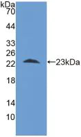 Western blot - Anti-STIP1/STI1 antibody (AB233196)