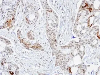 Immunohistochemistry (Formalin/PFA-fixed paraffin-embedded sections) - Anti-STIP1/STI1 antibody (AB96550)