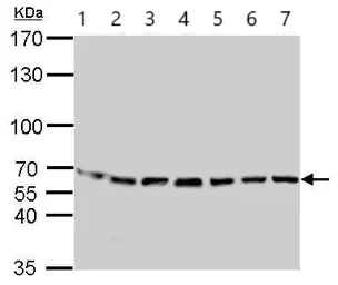 Western blot - Anti-STIP1/STI1 antibody (AB96550)