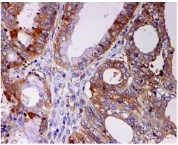 Immunohistochemistry (Formalin/PFA-fixed paraffin-embedded sections) - Anti-STIP1/STI1 antibody [EPR6605] (ab126724), expandable thumbnail
