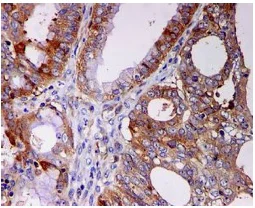 Immunohistochemistry (Formalin/PFA-fixed paraffin-embedded sections) - Anti-STIP1/STI1 antibody [EPR6605] (AB126724)