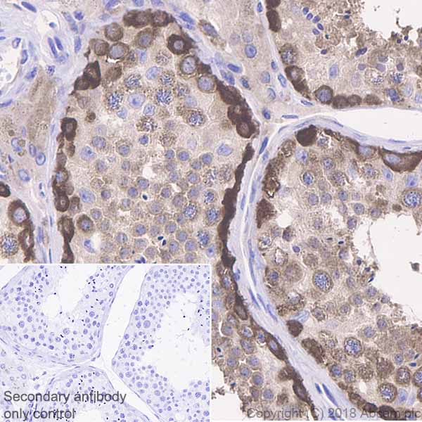 Immunohistochemistry (Formalin/PFA-fixed paraffin-embedded sections) - Anti-STIP1/STI1 antibody [EPR6605] (AB126724), expandable thumbnail
