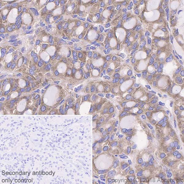Immunohistochemistry (Formalin/PFA-fixed paraffin-embedded sections) - Anti-STIP1/STI1 antibody [EPR6605] (AB126724), expandable thumbnail