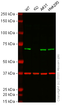 Western blot - Anti-STIP1/STI1 antibody [EPR6605] (AB126724), expandable thumbnail