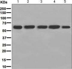 Western blot - Anti-STIP1/STI1 antibody [EPR6605] (ab126724), expandable thumbnail