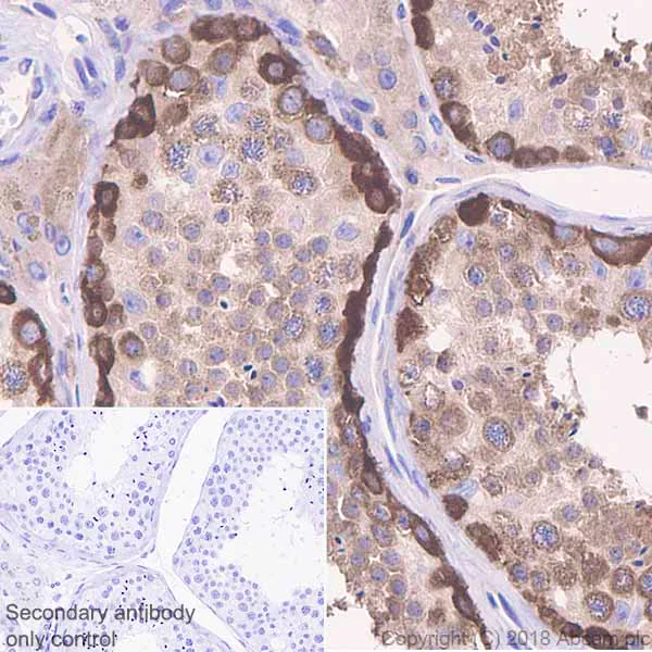 Immunohistochemistry (Formalin/PFA-fixed paraffin-embedded sections) - Anti-STIP1/STI1 antibody [EPR6605] - BSA and Azide free (AB238963)