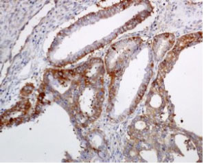 Immunohistochemistry (Formalin/PFA-fixed paraffin-embedded sections) - Anti-STIP1/STI1 antibody [EPR6606] (AB126753)