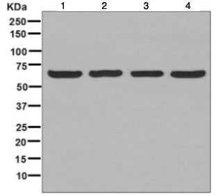 Western blot - Anti-STIP1/STI1 antibody [EPR6606] (AB126753)