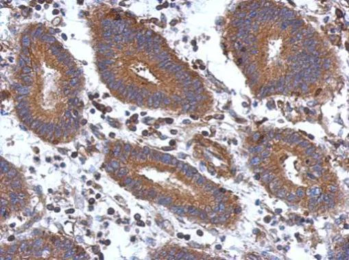 Immunohistochemistry (Formalin/PFA-fixed paraffin-embedded sections) - Anti-STK16 antibody (AB228608)