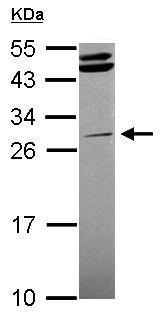 Western blot - Anti-STK16 antibody (AB228608)
