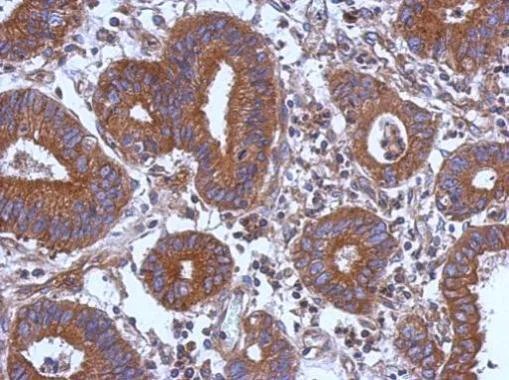 Immunohistochemistry (Formalin/PFA-fixed paraffin-embedded sections) - Anti-STK16 antibody (AB228806)