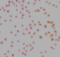 Immunocytochemistry - Anti-STK17A antibody (AB8418)