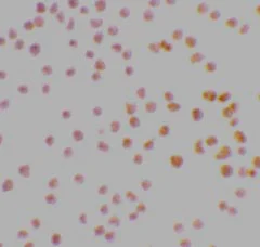 Immunocytochemistry - Anti-STK17A antibody (AB8418)