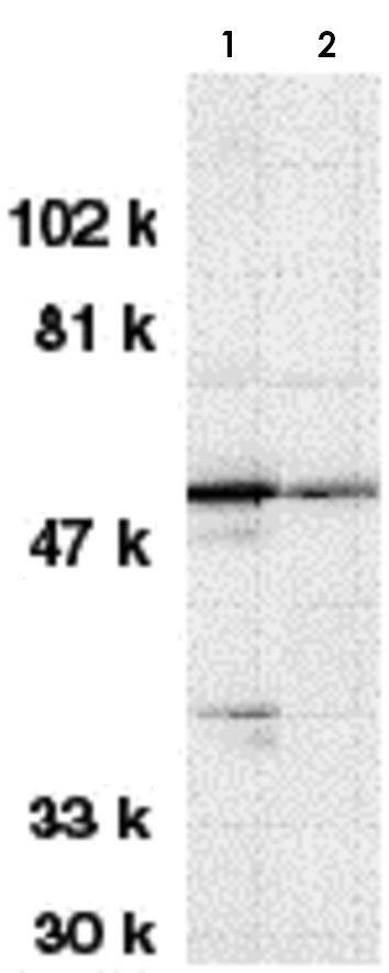 Western blot - Anti-STK17A antibody (AB8418)