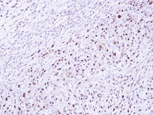 Immunohistochemistry (Formalin/PFA-fixed paraffin-embedded sections) - Anti-STK17A antibody (AB97530)