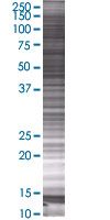 STK17A overexpression 293T lysate (whole cell)