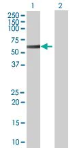 Western blot - STK17A overexpression 293T lysate (whole cell) (AB94107)
