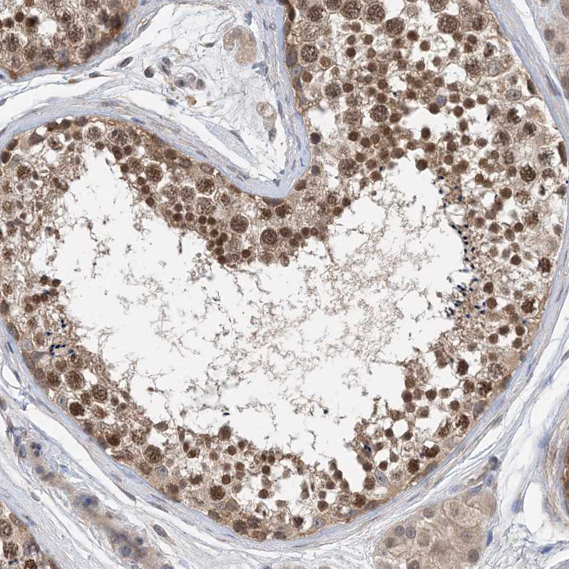 Immunohistochemistry (Formalin/PFA-fixed paraffin-embedded sections) - Anti-STK19/G11 antibody (AB251814)