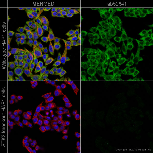 Immunocytochemistry/ Immunofluorescence - Anti-STK3/MST-2 antibody [EP1466Y] (AB52641), expandable thumbnail