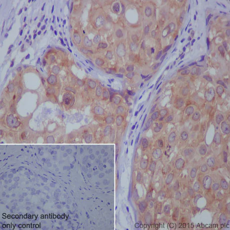 Immunohistochemistry (Formalin/PFA-fixed paraffin-embedded sections) - Anti-STK3/MST-2 antibody [EP1466Y] (AB52641)