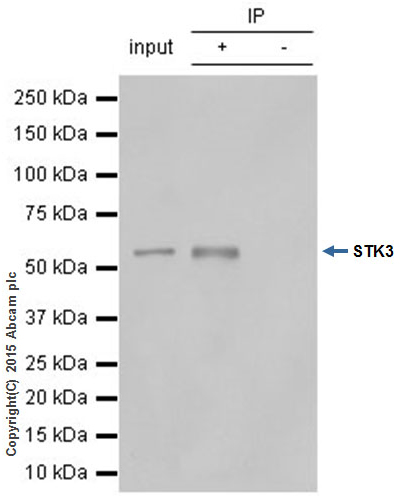 Immunoprecipitation - Anti-STK3/MST-2 antibody [EP1466Y] (AB52641), expandable thumbnail