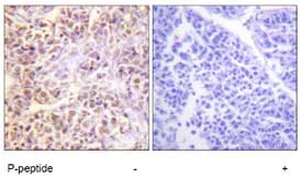Immunohistochemistry (Formalin/PFA-fixed paraffin-embedded sections) - Anti-STK3/MST-2 (phospho T180) + MSP/MST1 (phospho T183) antibody (AB79199)