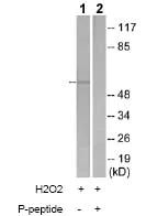 Western blot - Anti-STK3/MST-2 (phospho T180) + MSP/MST1 (phospho T183) antibody (AB79199)