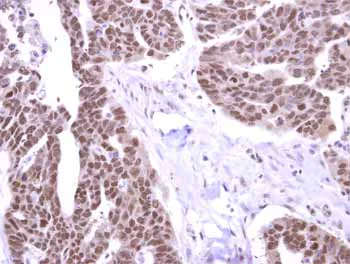 Immunohistochemistry (Formalin/PFA-fixed paraffin-embedded sections) - Anti-STK31 antibody (AB155172)