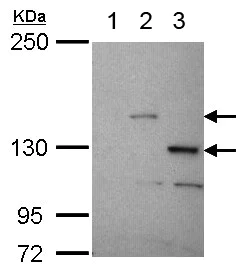 Western blot - Anti-STK31 antibody (AB155172)