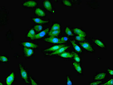 Immunocytochemistry/ Immunofluorescence - Anti-STK33 antibody (AB237759)