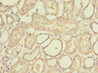 Immunohistochemistry (Formalin/PFA-fixed paraffin-embedded sections) - Anti-STK33 antibody (AB237759)