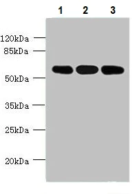 Western blot - Anti-STK33 antibody (AB237759)