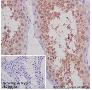Immunohistochemistry (Formalin/PFA-fixed paraffin-embedded sections) - Anti-STK33 antibody [EPR15343] (AB206296), expandable thumbnail